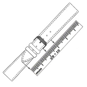 Uhrenarmbandüberstand + locker tragen